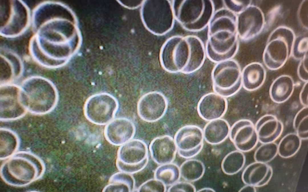 Dunkelfeld Diagnostik – Praktische Ausbildungstage